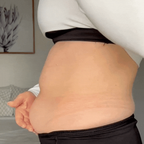 LiftNow™ Patches- Say goodbye to sagging skin and cellulite instantly