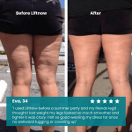 LiftNow™ Patches- Say goodbye to sagging skin and cellulite instantly
