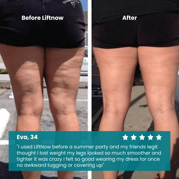 LiftNow™ Patches- Say goodbye to sagging skin and cellulite instantly